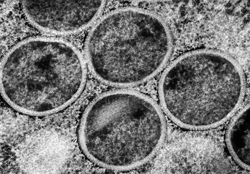 猴痘病毒进化与传播风险：新变种与潜在生育影响(图1)